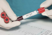 Photo of विश्व एड्स दिवस पर दूर करें इस बीमारी से जुड़ी 3 मिथक