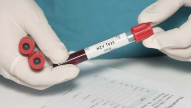 Photo of विश्व एड्स दिवस पर दूर करें इस बीमारी से जुड़ी 3 मिथक