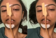 Photo of हेलमेट नहीं पहना और रैपिडो पर निकल पड़ी लड़की, रास्ते में हुई ऐसी दुर्घटना कि सबकुछ बदल गया