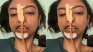 Photo of हेलमेट नहीं पहना और रैपिडो पर निकल पड़ी लड़की, रास्ते में हुई ऐसी दुर्घटना कि सबकुछ बदल गया