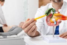 Photo of इन गलतियों की वजह से बढ़ जाता है गालब्लैडर स्टोन का जोखिम