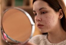 Photo of डर्मेटोलॉजिस्ट ने समझाया Skin Purging का साइंस