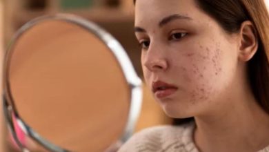 Photo of डर्मेटोलॉजिस्ट ने समझाया Skin Purging का साइंस