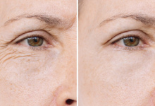 Photo of एक महीने में गायब होंगी झुर्रियां, अगर नियमित रूप से इस्तेमाल कर लिए ये नुस्खे!