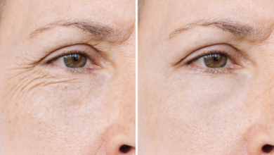 Photo of एक महीने में गायब होंगी झुर्रियां, अगर नियमित रूप से इस्तेमाल कर लिए ये नुस्खे!