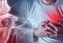 Photo of हार्ट अटैक मरीजों को एसएन मेडिकल में मिलेगी बड़ी राहत