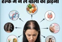 Photo of झड़ते और पतले बाल दे रहे हैं ये गंभीर चेतावनी, कहीं आप भी तो नहीं कर रहे ये गलती?