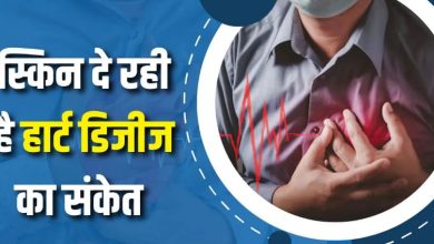 Photo of त्वचा पर दिखने वाले ये 5 निशान हो सकते हैं ‘हार्ट डिजीज’ का संकेत