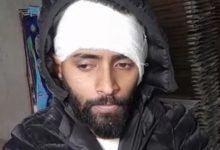 Photo of चाइनीज मांझे का कहर: जालंधर में बाइक सवार युवक का आधा कान कटा