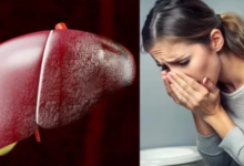 Photo of त्वचा पर नजर आते हैं लिवर की खराबी के 5 लक्षण