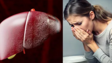 Photo of त्वचा पर नजर आते हैं लिवर की खराबी के 5 लक्षण