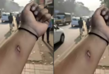 Photo of एआई से बनाई नकली चोट की फोटो भेजी और मिल गई छुट्टी