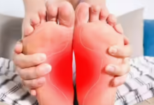 Photo of पैरों में ये लक्षण हो सकते है कैंसर की शुरुआत