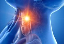 Photo of गले में खराश को झट से दूर कर सकते हैं ये घरेलू उपाय