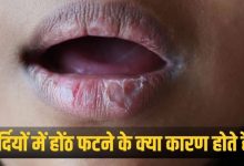 Photo of ठंड में ही क्यों ज्यादा फटते हैं होंठ? 