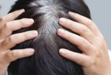 Photo of बुढ़ापे से पहले आपके बाल सफेद होने की असली वजह ये ‘कमी’ है