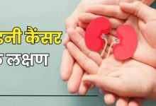 Photo of शरीर के 8 संकेत चीख-चीखकर बता रहे हैं कि किडनी मुसीबत में है, देरी किए बिना कराएं कैंसर की जांच