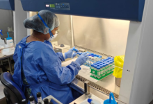 Photo of कैसे बनेगा टीबी मुक्त पंजाब?: रोजाना औसतन 172 नए केस आ रहे