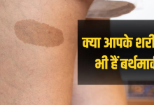Photo of जन्म के वक्त शरीर पर क्यों बनते हैं ये निशान? कब बन जाते हैं खतरनाक, जानिए सबकुछ