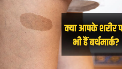 Photo of जन्म के वक्त शरीर पर क्यों बनते हैं ये निशान? कब बन जाते हैं खतरनाक, जानिए सबकुछ