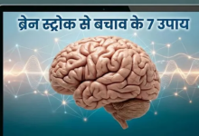 Photo of ब्रेन स्ट्रोक का खतरा टाल सकती हैं आपकी ये 7 आदतें