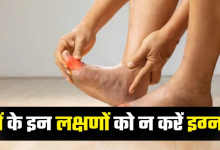 Photo of सोते समय पैरों में महसूस होती है ये चीज? सावधान, यह सामान्य थकान नहीं…
