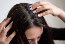 Photo of स्कैल्प की खुजली और डैंड्रफ से हैं परेशान? तो ट्राई करें दही से बने 3 हेयर मास्क