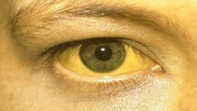 Photo of हरियाणा के इस जिले में 16 बच्चों में मिले पीलिया के लक्षण