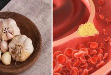 Photo of क्या सुबह लहसुन खाने से सचमुच कम होता है कोलेस्ट्रॉल?