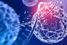 Photo of मामूली समझकर अनदेखा कर रहे हैं कैंसर के शुरुआती संकेत? 