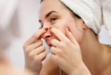 Photo of पिंपल्स फोड़ने की आदत बिगाड़ सकती है चेहरा, इन्फेक्शन और स्कारिंग का रहता है खतरा