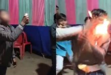 Photo of रील के लिए मौत का खेल! आग से स्टंट करते समय बच्चे का हुआ ऐसा हाल