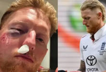 Photo of इंग्लैंड के कप्तान बेन स्टोक्स के चेहरे पर लगी भयानक चोट