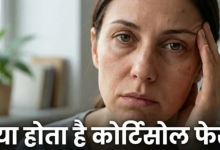 Photo of चेहरे पर सूजन और मुहांसे हो सकते हैं ‘Cortisol Face’ का संकेत
