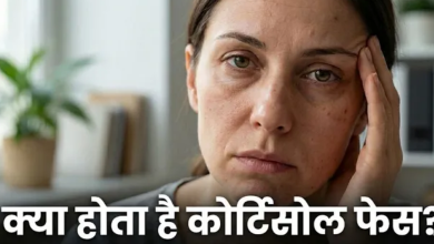 Photo of चेहरे पर सूजन और मुहांसे हो सकते हैं ‘Cortisol Face’ का संकेत