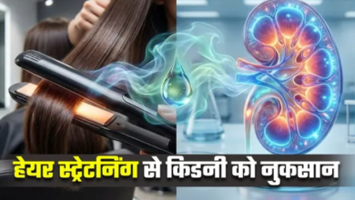 Photo of क्या हेयर स्ट्रेटनिंग के बाद डायलिसिस की नौबत आ सकती है?