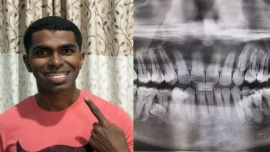 Photo of इस मलेशियाई व्यक्ति के मुंह में 32 नहीं बल्कि 42 दांत, बनाया वर्ल्ड रिकॉर्ड