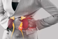 Photo of सेहत बनाने के चक्कर में किडनी खराब तो नहीं कर रहे आप? 