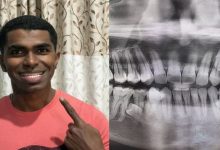 Photo of इस आदमी के मुंह में 32 नहीं, 42 दांत हैं, गिनीज वर्ल्ड रिकॉर्ड में हुआ शामिल