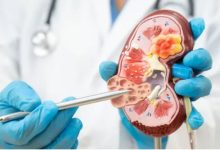 Photo of किडनी डिजीज को साइलेंट किलर क्यों कहा जाता है?