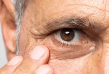Photo of नेत्र जांच से रोका जा सकता है ग्लूकोमा से अंधापन, एक्सपर्ट ने बताए बचाव के उपाय