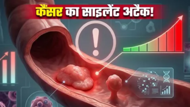 Photo of आंतों में इन दो तरह की गांठ से 5 गुना तक बढ़ जाता है कैंसर का खतरा