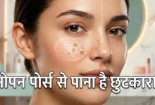 Photo of क्या बड़े पोर्स ने छीन ली है चेहरे की खूबसूरती? इन आसान तरीकों से पाएं इनसे छुटकारा