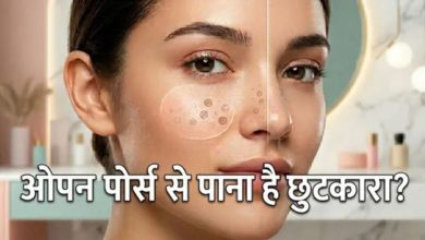 Photo of क्या बड़े पोर्स ने छीन ली है चेहरे की खूबसूरती? इन आसान तरीकों से पाएं इनसे छुटकारा