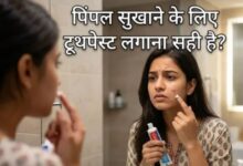 Photo of क्या पिंपल्स पर टूथपेस्ट लगाना सच में काम करता है? नुकसान से बचना है