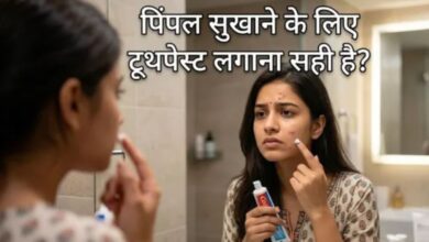 Photo of क्या पिंपल्स पर टूथपेस्ट लगाना सच में काम करता है? नुकसान से बचना है